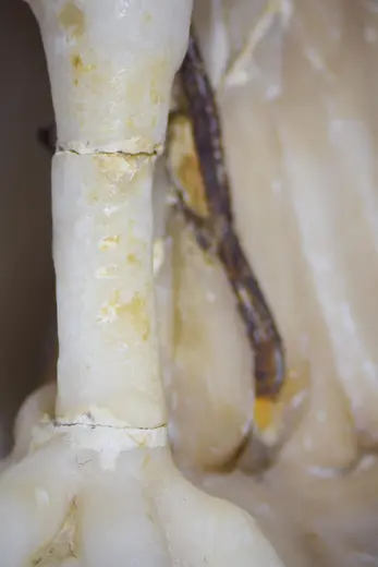 Nahaufnahme eines Knochens, der eine Rissstelle aufweist. Neben dem Knochen ist ein dunkler, schmaler Faden sichtbar, möglicherweise ein Nerv oder ein Band. Der Fokus liegt auf der Struktur und texturalen Details des Knochens.