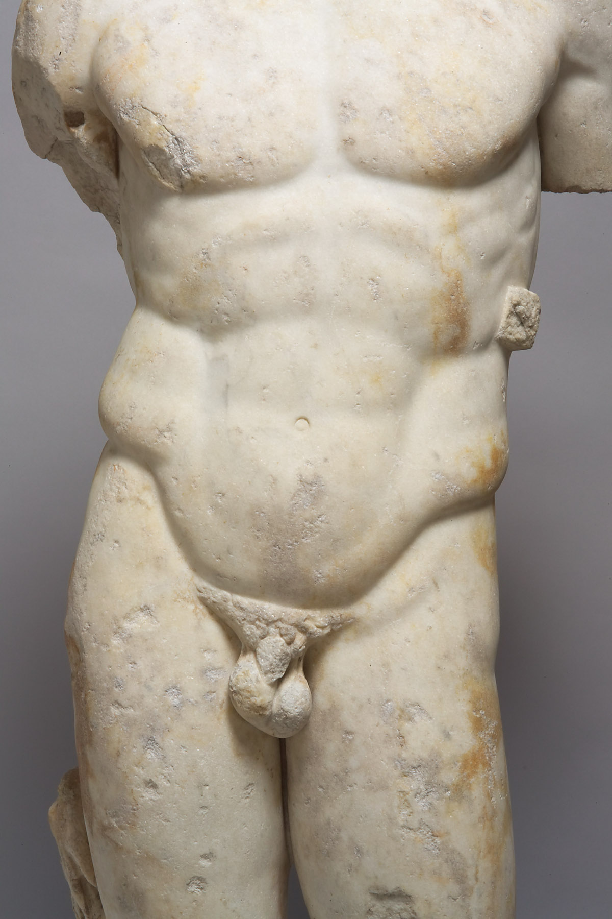 Torso des Speerträgers (Doryphoros)