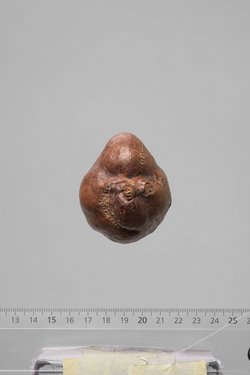 Früchte der Dumpalme