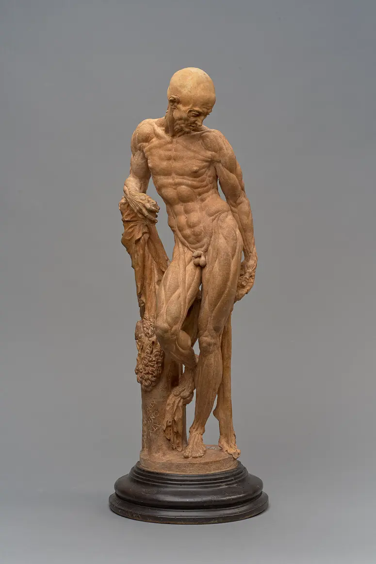 Ecorché (Muskelmann)