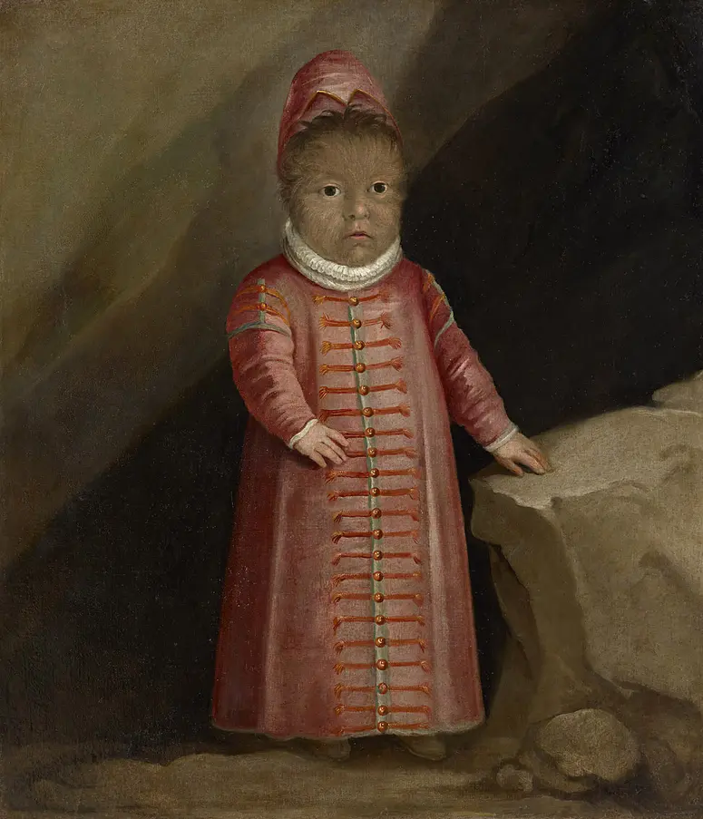Enrico Gonzales, Enrico Gonsalez, Sohn des Haarmenschen Petrus Gonzalez (Gonsalvus); Sohn des Haarmannes, geboren 1576