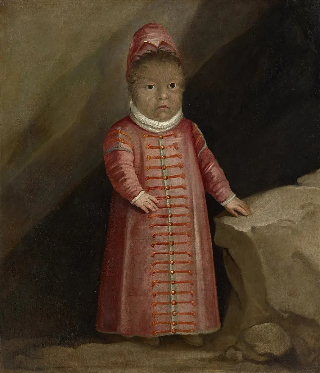 Enrico Gonzales, Enrico Gonsalez, Sohn des Haarmenschen Petrus Gonzalez (Gonsalvus); Sohn des Haarmannes, geboren 1576
