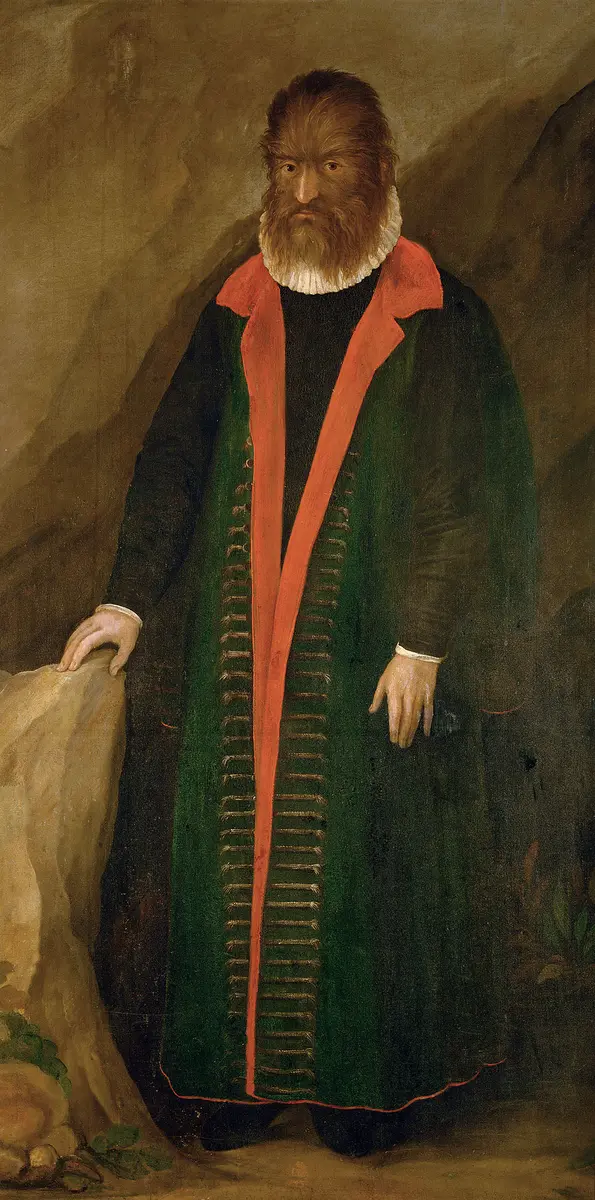 Haarmensch, Haarmann, Petrus Gonsalvus (geboren 1556), Pedro Gonsales, Pedro Gonsalez